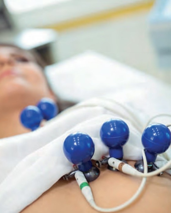 Eletrodos de eletrocardiograma posicionados no paciente