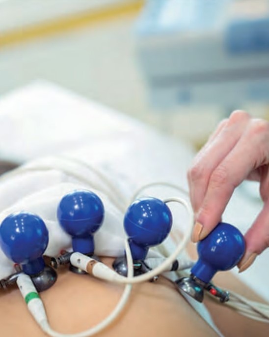 Eletrodos de alta resolução posicionados para registro eletrocardiográfico